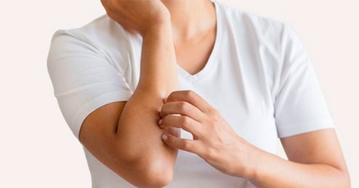 alt="alergia-a-roupa-5-causas-de-alergias-na-pele-que-você-não-sabia"