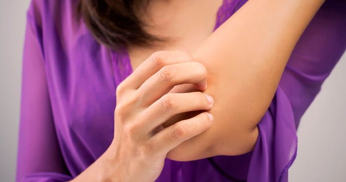 alt="alergia-a-roupa-5-causas-de-alergias-na-pele-que-você-não-sabia"