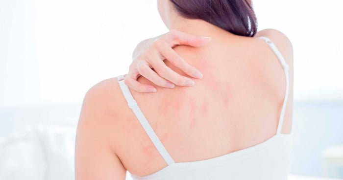  alt="alergia-a-roupa-5-causas-de-alergias-na-pele-que-você-não-sabia"